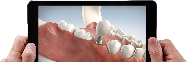 Smile 3D